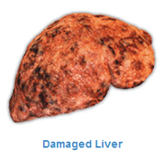 Liver